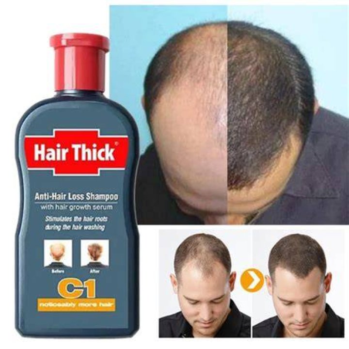 2018 New Professional Hair Growth 200ml Anti Hair Loss Shampoo Original