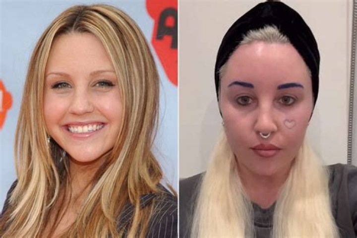 Amanda Bynes Now: A Journey Through Challenges And Triumphs