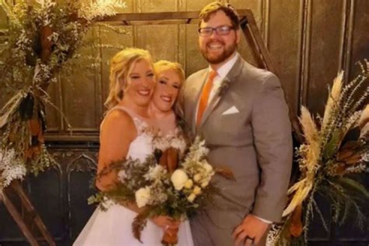 Are abby and brittany hensel conjoined twins married legsbm