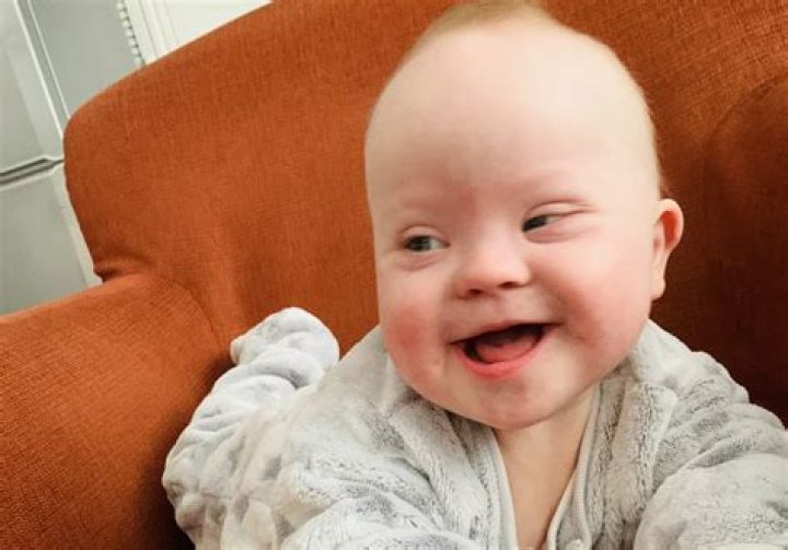 Does Baby Crew Have Down Syndrome?