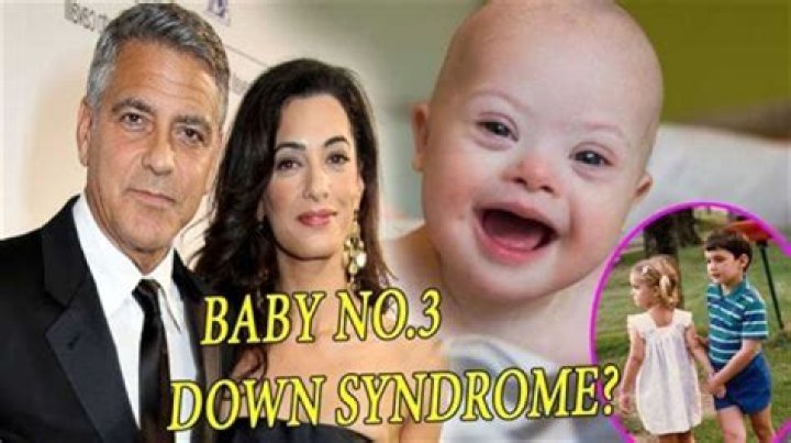 Does George Clooney's Son Have Down Syndrome? Unraveling The Truth