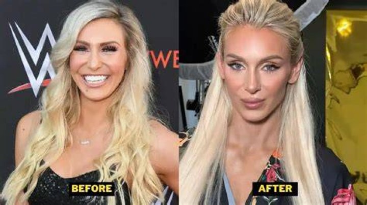 ‘Doesn’t Melt in the Sun’: Called Out for Too Much Plastic Surgery, Charlotte
Flair Issues Classy Response to Insensitive Troll
