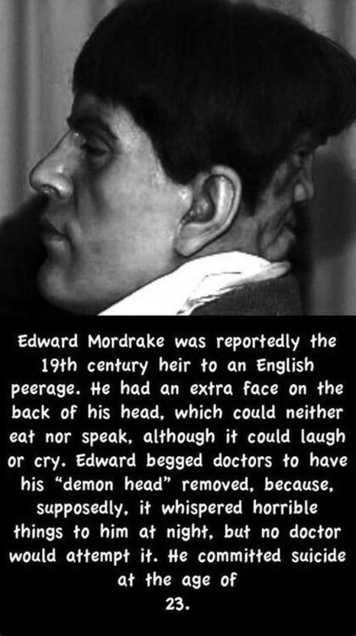 Edward Mordake: The Fascinating Tale Of The Man With A Second Face