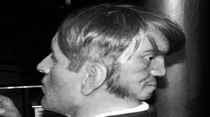 Edward Mordrake, the Man with Two Faces