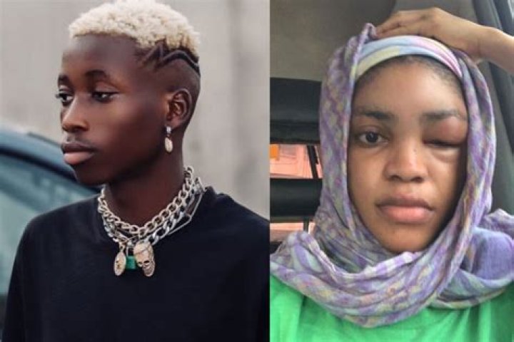 Ex DMW rapper, Lil Frosh finally speaks after beating girlfriend to pulp