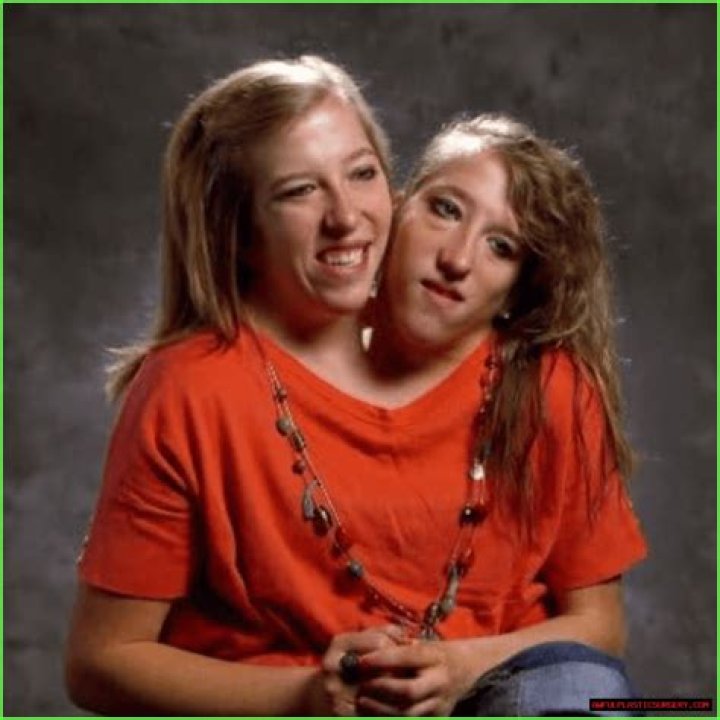 Exploring The Conelle Twins: A Journey Into Their Lives, Careers, And Influence