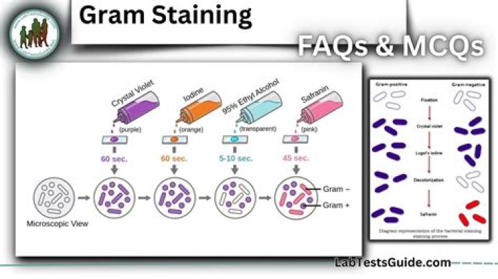 Gram Boast Gratings belongs adenine seasoned technics the possesses