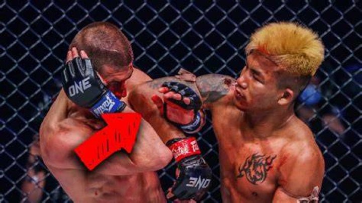 “He Sharpened His Elbows” – MMA Fans Can’t Believe Insane Midfight Injury During
ONE Championship Bout