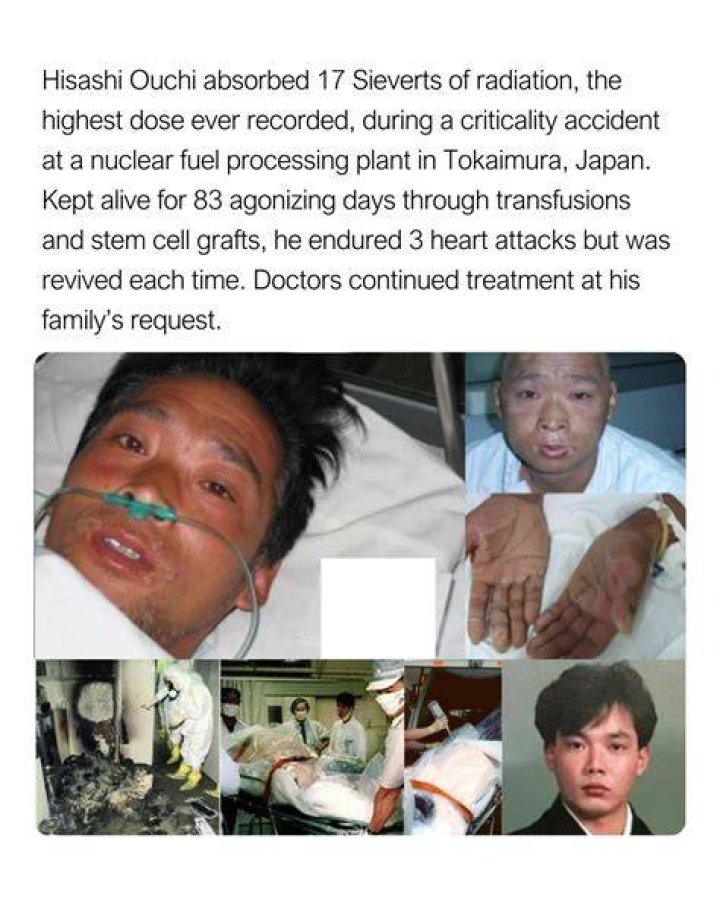Hisashi Ouchi: A Comprehensive Look At The Tragic Case Of The Fukushima Worker
