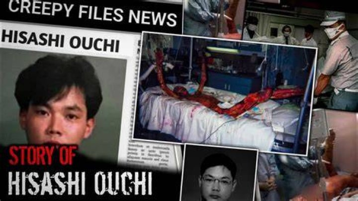Hisashi Ouchi Corpse