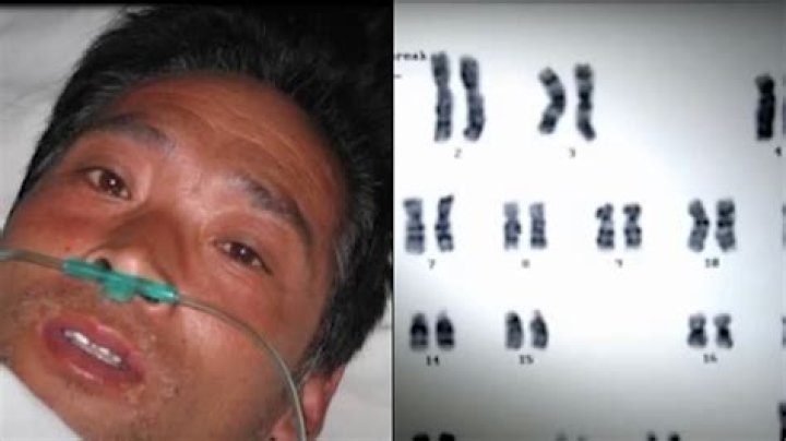 Hisashi Ouchi: The Man Behind The 83 Days Of Suffering