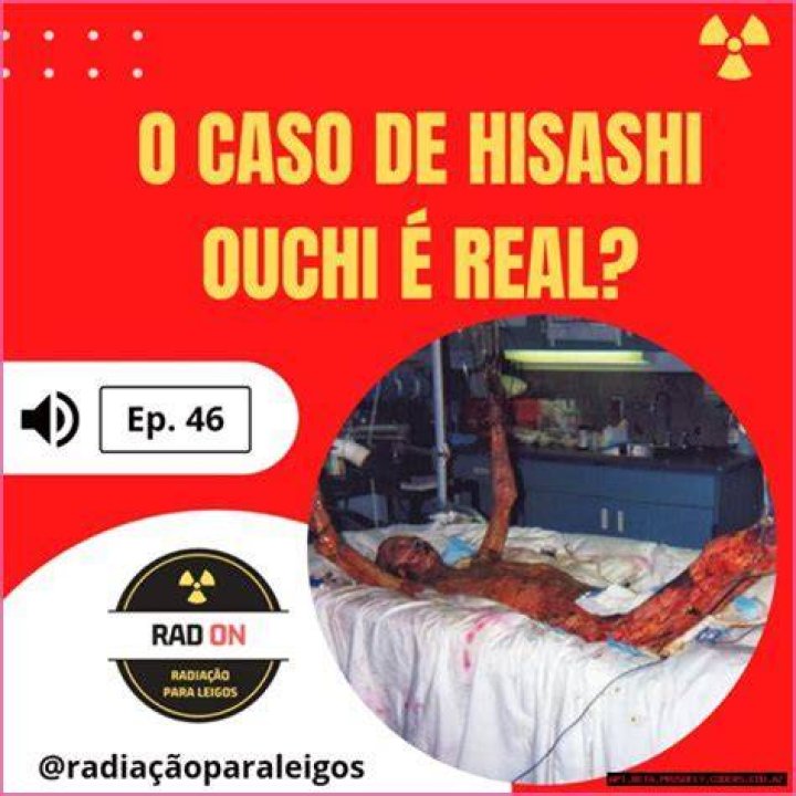 Hisashi Real Photos: Capturing The Essence Of Reality In Photography