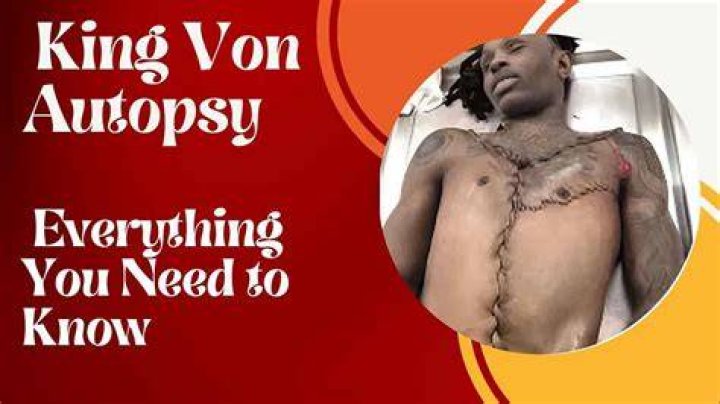 King Von Death Autopsy Unraveling The Mystery Behind His Untimely Demise