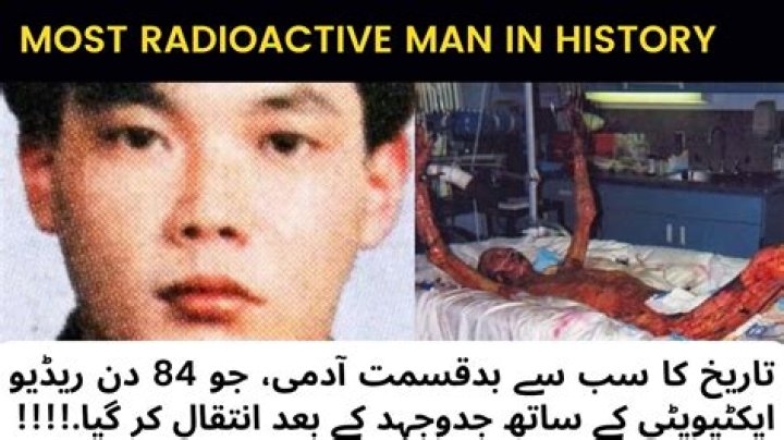 Most Radioactive Man in History Hisashi Ouchi's Story in Hindi YouTube