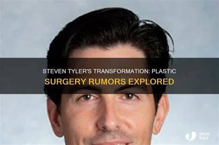 Steven Crowder&rsquo;s Plastic Surgery What Did He Post in Twitter