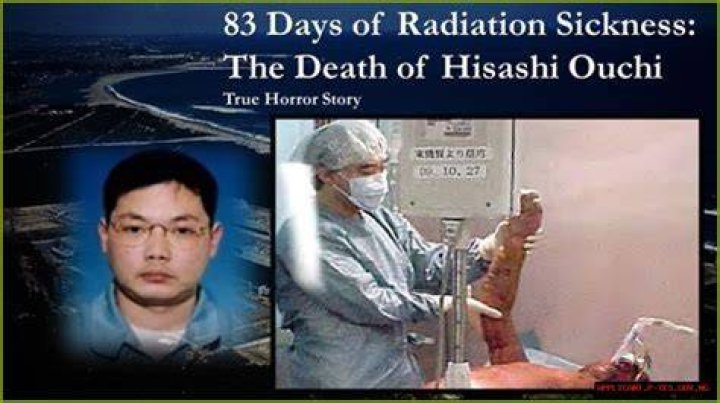 The Lasting Legacy Hisashi Ouchi And The Devastating Impact Of Radiation