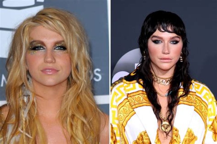The Transformation Of Kesha From Childhood To 34