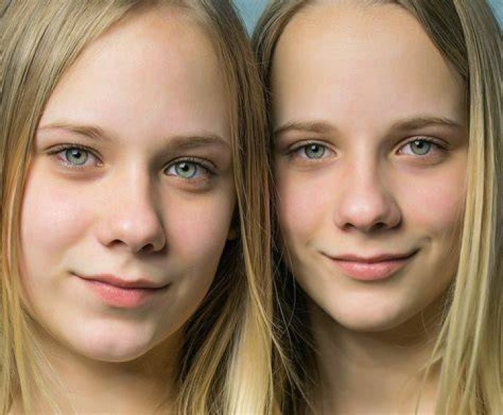 THE TWINS Twins, Dream, Face, The Face, Gemini, Faces, Twin, Facial