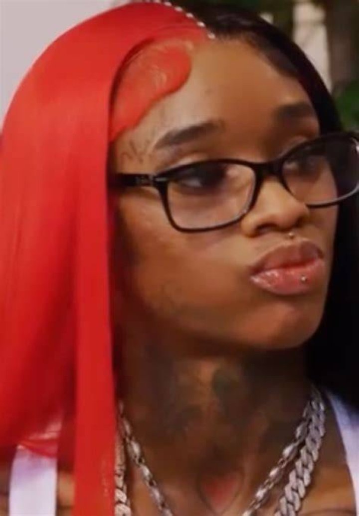 UH Oh!! Female Rapper Sexyy Red Seen w/ Mystery SORE On Her Top Lip