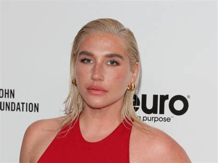 Understanding Kesha's Age: A Deep Dive Into Her Life And Career
