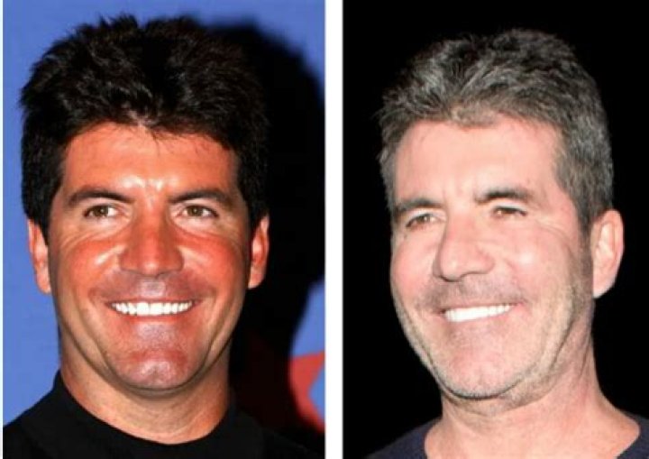 Understanding Simon Cowell's Son Diagnosis A Personal Journey