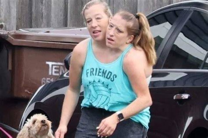 Understanding The Abby And Brittany Hensel Family Tragedy