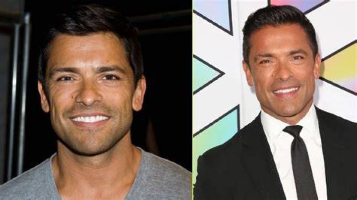 Unveiling Mark Consuelos' Transformation: Plastic Surgery Secrets Revealed