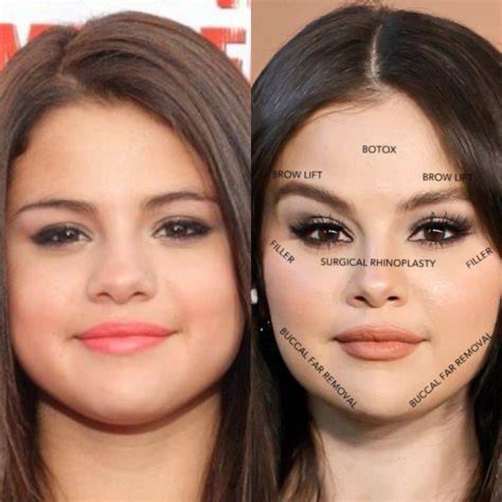 Years After Undergoing Life Saving Surgery Due to Rare Disease, Selena Gomez
Wins Hearts at the Lakers Game With “Gorgeous” Transformation