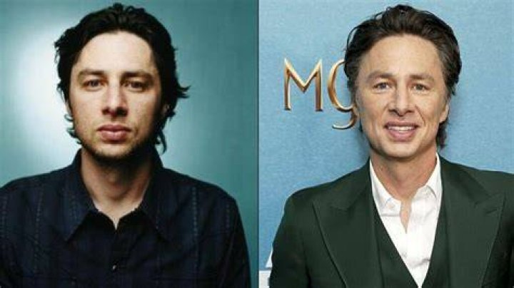 Zach Braff Plastic Surgery: Exploring The Transformation Of A Beloved Actor